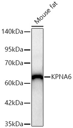 KPNA6 Antibody in Western Blot (WB)