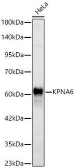 KPNA6 Antibody in Western Blot (WB)
