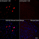 beta Amyloid (1-40) Recombinant Rabbit Monoclonal Antibody (2V1M6)