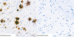 beta Amyloid (1-40) Antibody in Immunohistochemistry (Paraffin) (IHC (P))