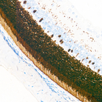 Recoverin Antibody in Immunohistochemistry (Paraffin) (IHC (P))
