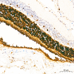 Recoverin Recombinant Rabbit Monoclonal Antibody (2E4S7)