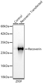 Recoverin Antibody in Western Blot (WB)