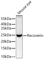 Recoverin Antibody in Western Blot (WB)
