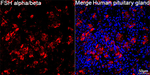 Follicle Stimulating Hormone Recombinant Rabbit Monoclonal Antibody (7Q5W2)