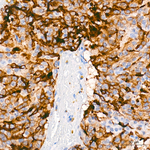Follicle Stimulating Hormone Antibody in Immunohistochemistry (Paraffin) (IHC (P))