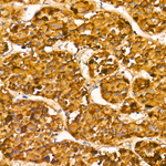 Follicle Stimulating Hormone Antibody in Immunohistochemistry (Paraffin) (IHC (P))