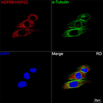 HSPB8 Antibody in Immunocytochemistry (ICC/IF)
