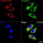 HSPB8 Recombinant Rabbit Monoclonal Antibody (9F3W3)