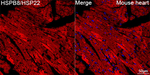 HSPB8 Antibody in Immunohistochemistry (Paraffin) (IHC (P))