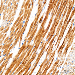 HSPB8 Antibody in Immunohistochemistry (Paraffin) (IHC (P))