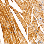 HSPB8 Antibody in Immunohistochemistry (Paraffin) (IHC (P))