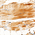 HSPB8 Antibody in Immunohistochemistry (Paraffin) (IHC (P))