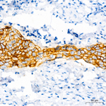 CD138 Antibody in Immunohistochemistry (Paraffin) (IHC (P))