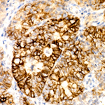 CD138 Antibody in Immunohistochemistry (Paraffin) (IHC (P))
