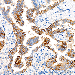 CD138 Recombinant Rabbit Monoclonal Antibody (3O7R2)