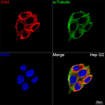 FAH Recombinant Rabbit Monoclonal Antibody (10B2E9)