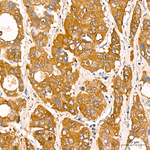 FAH Antibody in Immunohistochemistry (Paraffin) (IHC (P))