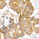 FAH Antibody in Immunohistochemistry (Paraffin) (IHC (P))