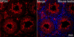 GPX4 Recombinant Rabbit Monoclonal Antibody (7B1A7)