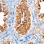 GPX4 Antibody in Immunohistochemistry (Paraffin) (IHC (P))