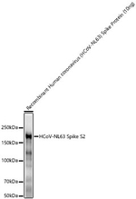 HCoV-NL63 Spike S2 Recombinant Rabbit Monoclonal Antibody (8B7P2)