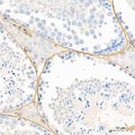 Laminin gamma-1 Antibody in Immunohistochemistry (Paraffin) (IHC (P))