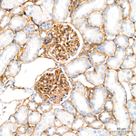 Laminin gamma-1 Antibody in Immunohistochemistry (Paraffin) (IHC (P))