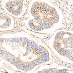 GOLGA4 Recombinant Rabbit Monoclonal Antibody (8J4K1)