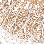 GOLGA4 Antibody in Immunohistochemistry (Paraffin) (IHC (P))