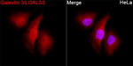 Galectin 3 Recombinant Rabbit Monoclonal Antibody (7N10G5)
