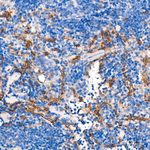 VE-cadherin Antibody in Immunohistochemistry (Paraffin) (IHC (P))