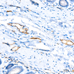 VE-cadherin Antibody in Immunohistochemistry (Paraffin) (IHC (P))