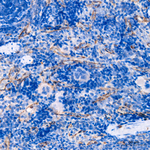 VE-cadherin Antibody in Immunohistochemistry (Paraffin) (IHC (P))