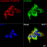 Cytokeratin 19 Recombinant Rabbit Monoclonal Antibody (9V2F4)