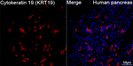 Cytokeratin 19 Antibody in Immunohistochemistry (Paraffin) (IHC (P))