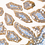 Cytokeratin 19 Antibody in Immunohistochemistry (Paraffin) (IHC (P))