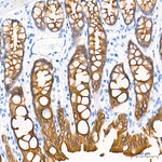 Cytokeratin 19 Antibody in Immunohistochemistry (Paraffin) (IHC (P))