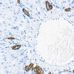 Cytokeratin 19 Antibody in Immunohistochemistry (Paraffin) (IHC (P))