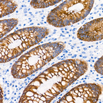 Cytokeratin 19 Antibody in Immunohistochemistry (Paraffin) (IHC (P))