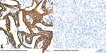 Cytokeratin 19 Antibody in Immunohistochemistry (Paraffin) (IHC (P))