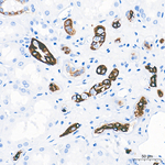 Cytokeratin 19 Antibody in Immunohistochemistry (Paraffin) (IHC (P))