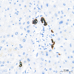 Cytokeratin 19 Antibody in Immunohistochemistry (Paraffin) (IHC (P))