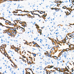 Cytokeratin 19 Antibody in Immunohistochemistry (Paraffin) (IHC (P))