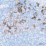 Cytokeratin 19 Antibody in Immunohistochemistry (Paraffin) (IHC (P))