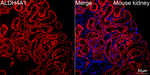 ALDH4A1 Antibody in Immunohistochemistry (Paraffin) (IHC (P))