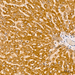 ALDH4A1 Antibody in Immunohistochemistry (Paraffin) (IHC (P))