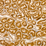 ALDH4A1 Antibody in Immunohistochemistry (Paraffin) (IHC (P))