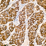 ALDH4A1 Antibody in Immunohistochemistry (Paraffin) (IHC (P))