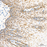 ALDH4A1 Antibody in Immunohistochemistry (Paraffin) (IHC (P))